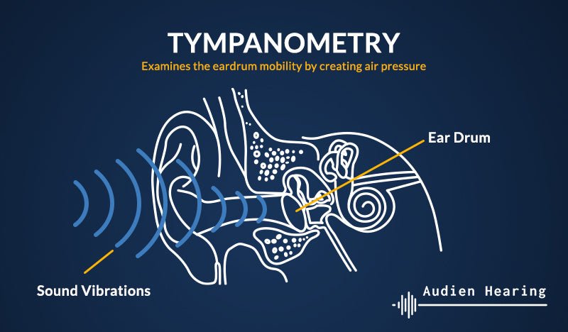 La tympanométrie
