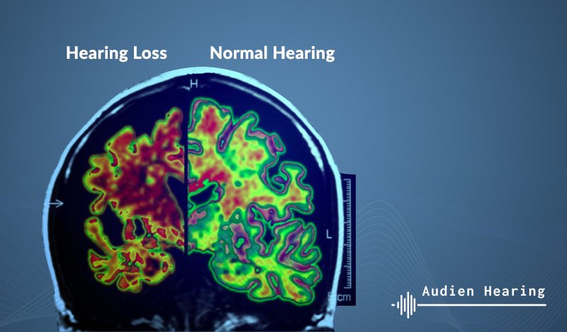 De nouvelles recherches relient la perte auditive à Alzheimer, à la démence, à la dépression et bien plus...